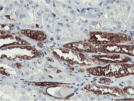 PFKP Antibody in Immunohistochemistry (Paraffin) (IHC (P))