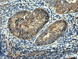 PFKP Antibody in Immunohistochemistry (Paraffin) (IHC (P))