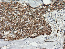 PFKP Antibody in Immunohistochemistry (Paraffin) (IHC (P))