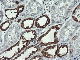 PFKP Antibody in Immunohistochemistry (Paraffin) (IHC (P))