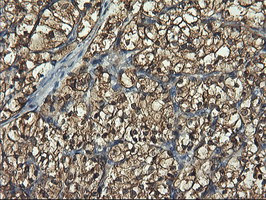 PFKP Antibody in Immunohistochemistry (Paraffin) (IHC (P))