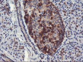 PFKP Antibody in Immunohistochemistry (Paraffin) (IHC (P))