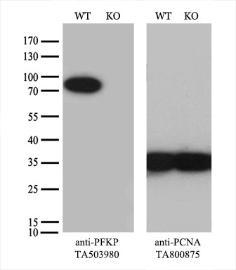 PFKP Antibody