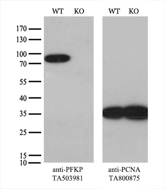 PFKP Antibody