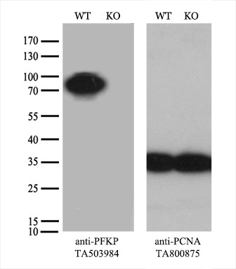 PFKP Antibody