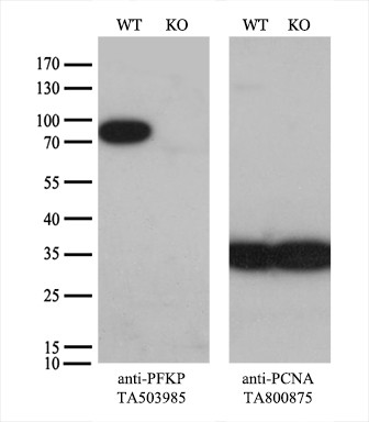 PFKP Antibody