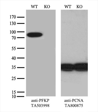 PFKP Antibody