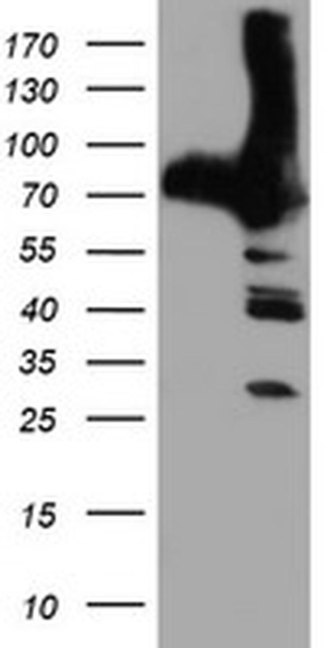 PFKP Antibody in Western Blot (WB)