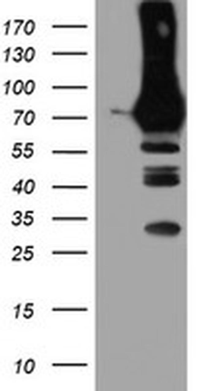 PFKP Antibody in Western Blot (WB)