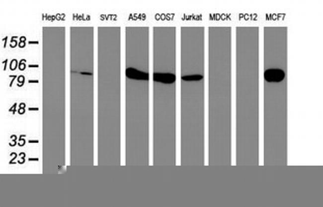 PFKP Antibody in Western Blot (WB)