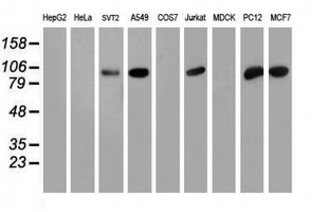 PFKP Antibody in Western Blot (WB)