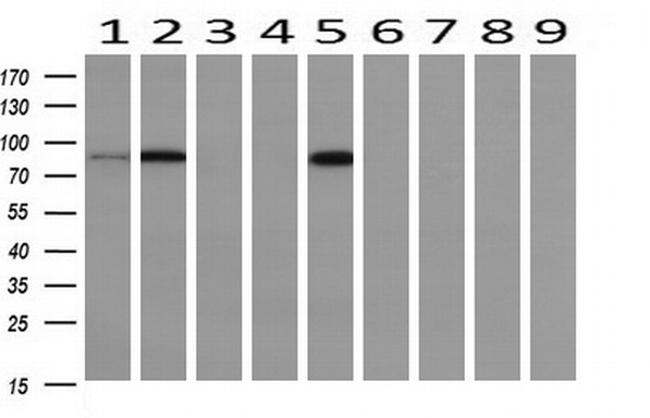 PFKP Antibody in Western Blot (WB)