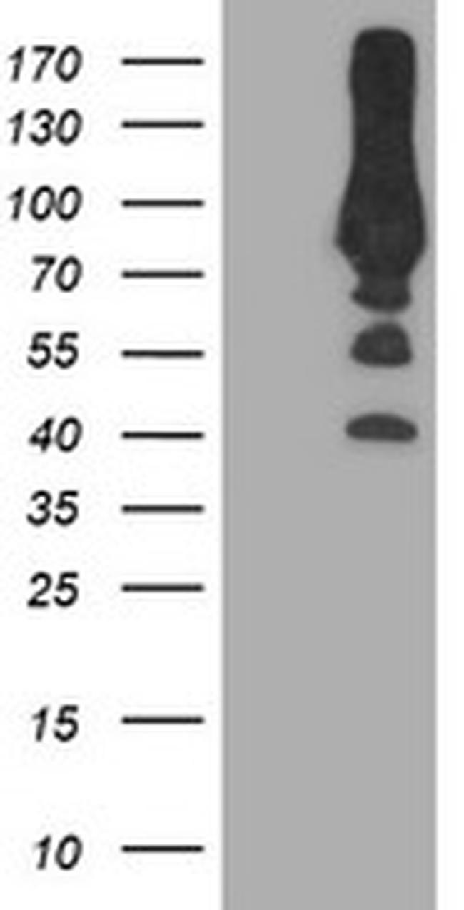 PFKP Antibody in Western Blot (WB)