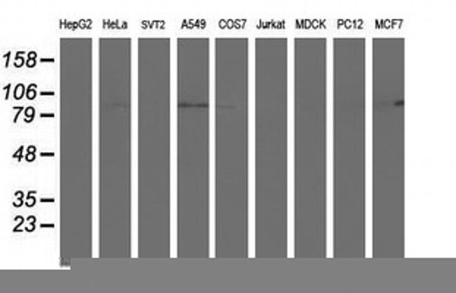 PFKP Antibody in Western Blot (WB)