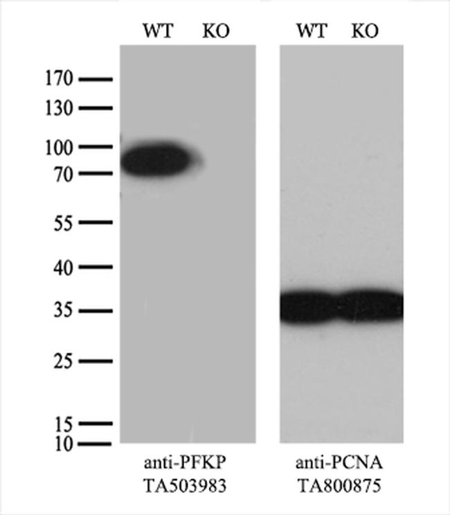 PFKP Antibody in Western Blot (WB)