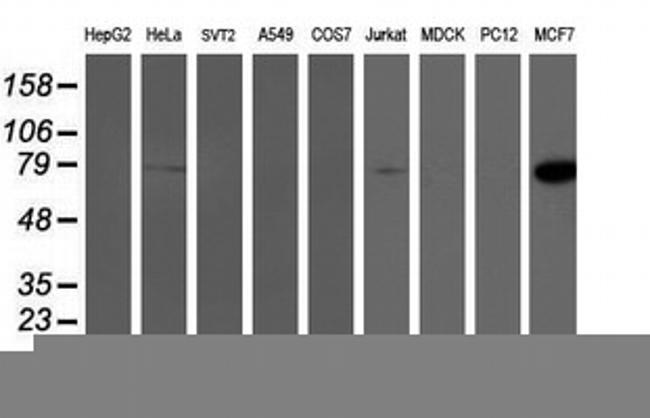 PFKP Antibody in Western Blot (WB)