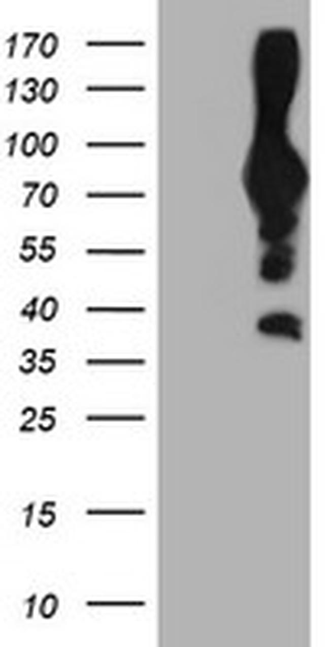 PFKP Antibody in Western Blot (WB)