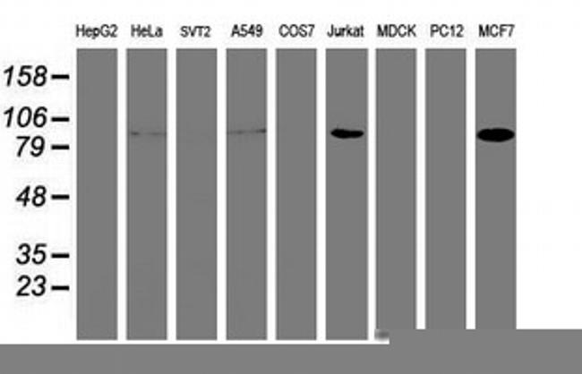 PFKP Antibody in Western Blot (WB)