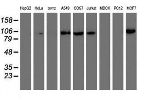 PFKP Antibody in Western Blot (WB)