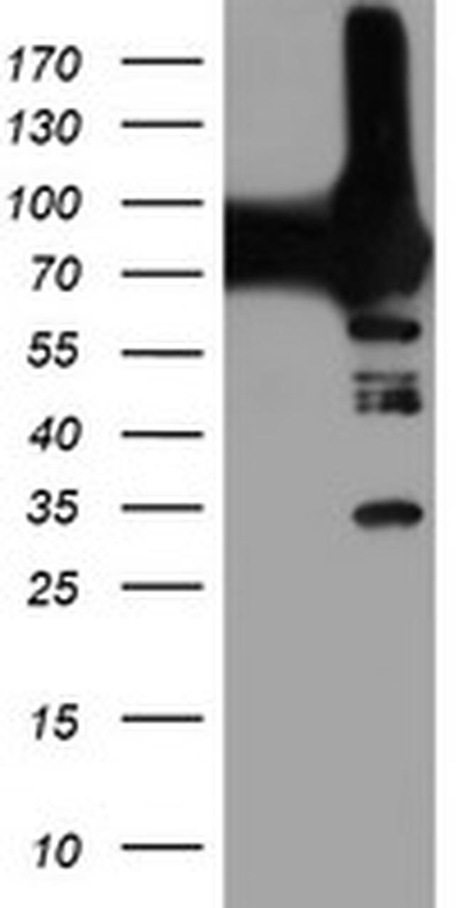 PFKP Antibody in Western Blot (WB)