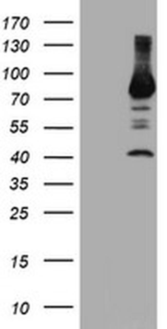 PFKP Antibody in Western Blot (WB)