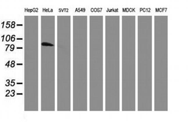 PFKP Antibody in Western Blot (WB)