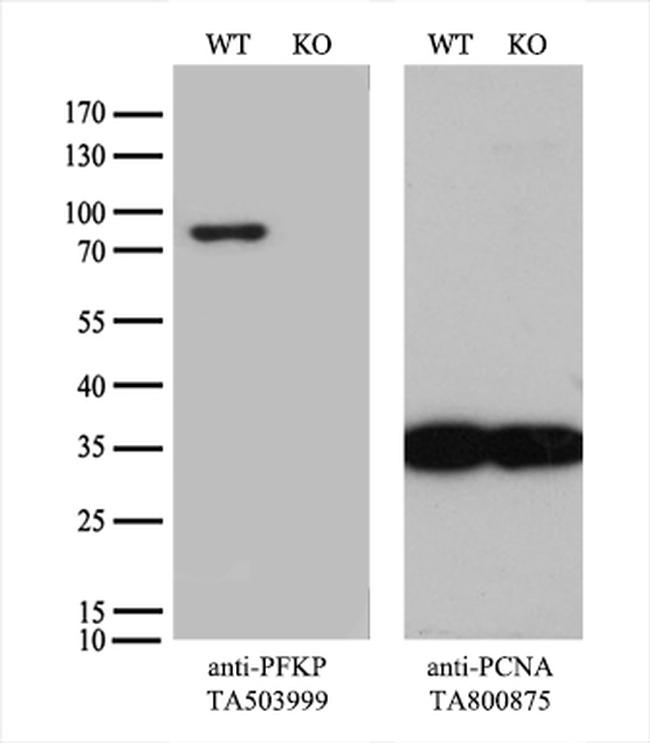 PFKP Antibody in Western Blot (WB)