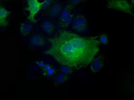 PFN1 Antibody in Immunocytochemistry (ICC/IF)