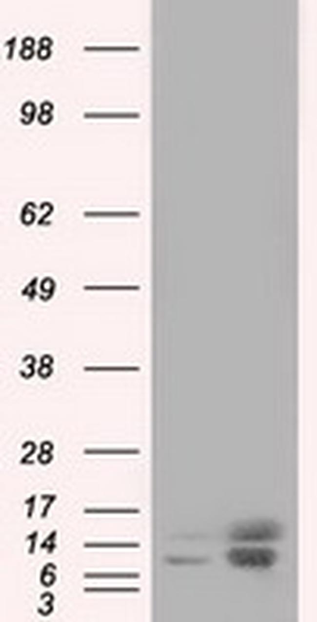 PFN1 Antibody in Western Blot (WB)