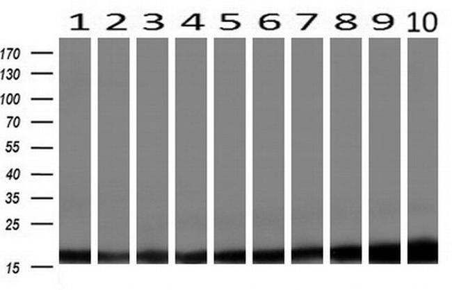 PFN1 Antibody in Western Blot (WB)