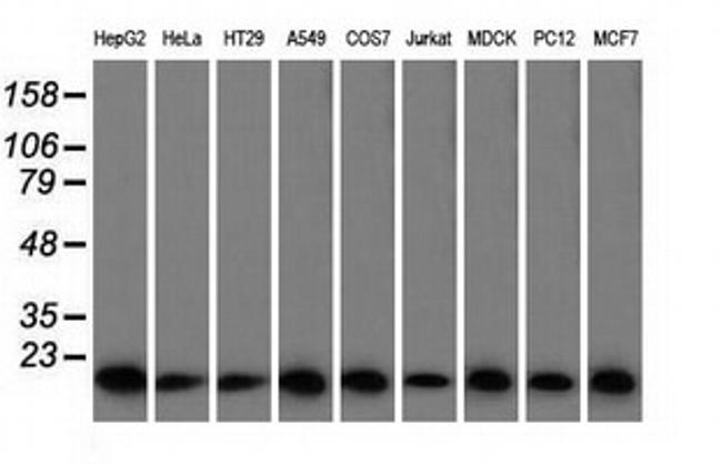 PFN1 Antibody in Western Blot (WB)