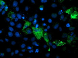 PGAM2 Antibody in Immunocytochemistry (ICC/IF)