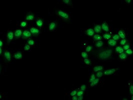 PGAM2 Antibody in Immunocytochemistry (ICC/IF)