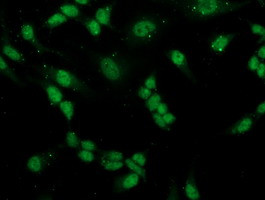 PGAM2 Antibody in Immunocytochemistry (ICC/IF)