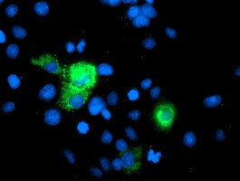 PGAM2 Antibody in Immunocytochemistry (ICC/IF)