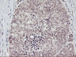 PGAM2 Antibody in Immunohistochemistry (Paraffin) (IHC (P))