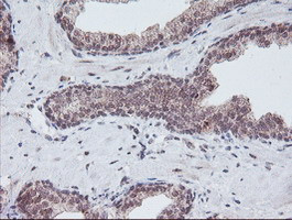 PGAM2 Antibody in Immunohistochemistry (Paraffin) (IHC (P))