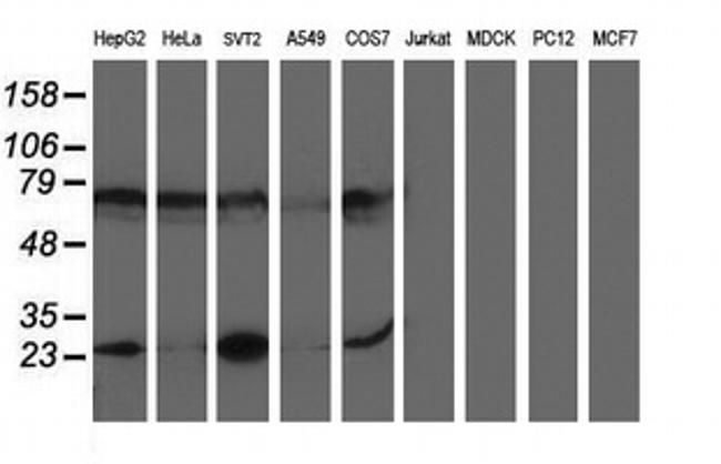 PGAM2 Antibody in Western Blot (WB)