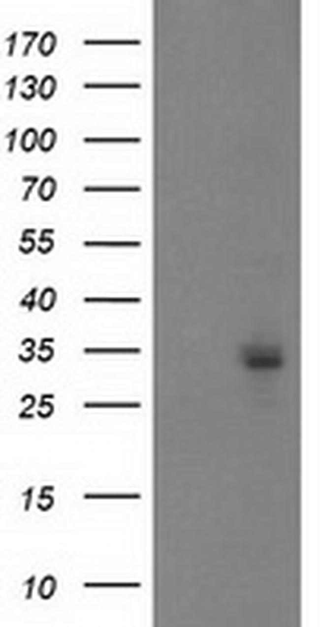 PGAM2 Antibody in Western Blot (WB)