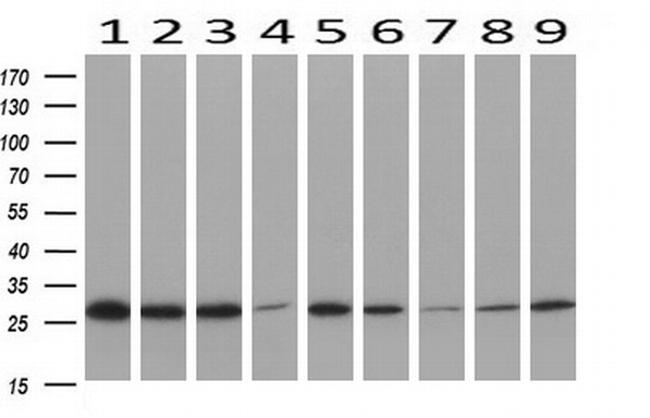 PGAM2 Antibody in Western Blot (WB)