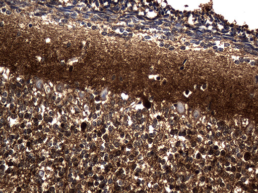 PGAM4 Antibody in Immunohistochemistry (Paraffin) (IHC (P))