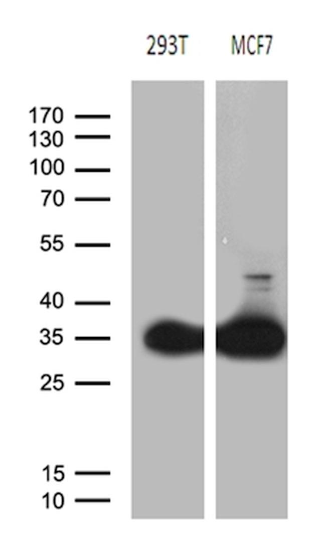 PGAM4 Antibody in Western Blot (WB)