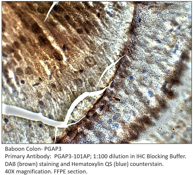 PGAP3 Antibody in Immunohistochemistry (IHC)