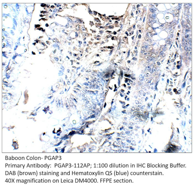 PGAP3 Antibody in Immunohistochemistry (IHC)