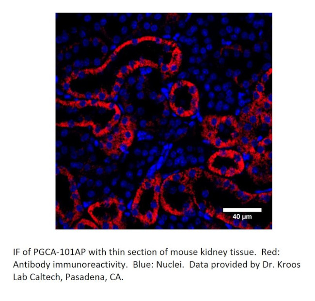 PGCA Antibody in Immunohistochemistry (IHC)