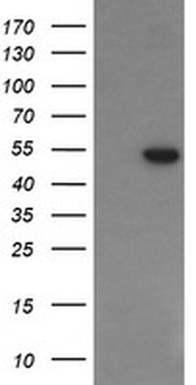 PGD Antibody in Western Blot (WB)
