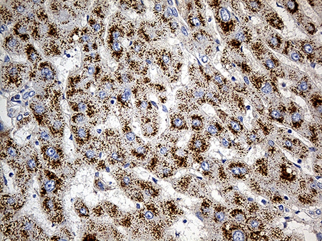 PGM2L1 Antibody in Immunohistochemistry (Paraffin) (IHC (P))