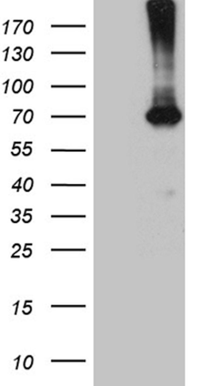 PGM2L1 Antibody in Western Blot (WB)