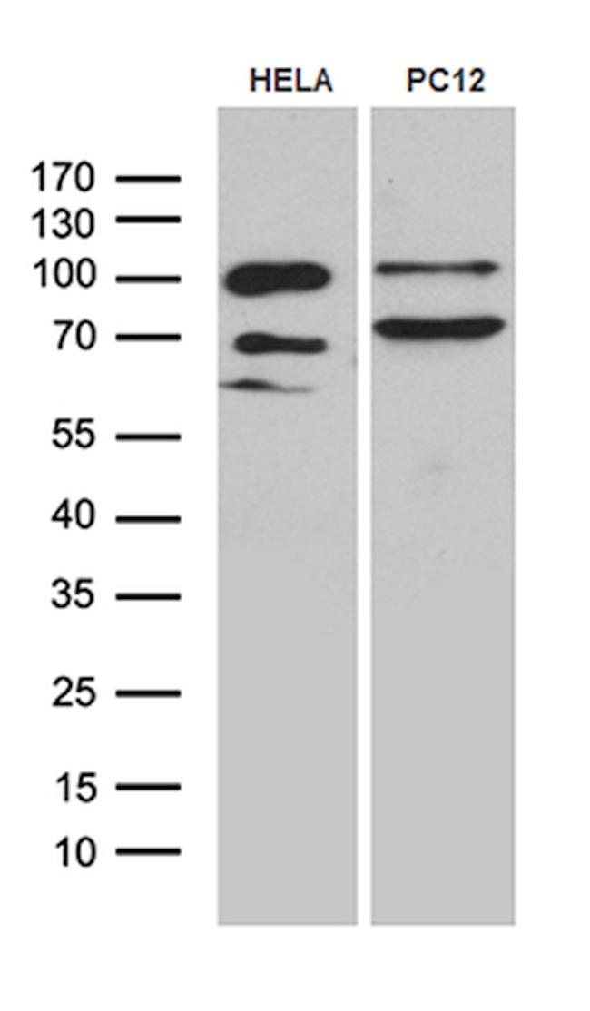 PGM2L1 Antibody in Western Blot (WB)