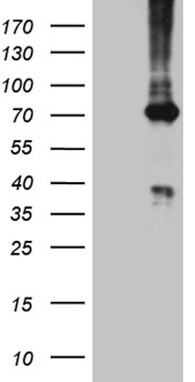 PGM2L1 Antibody in Western Blot (WB)